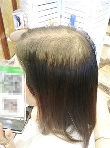 成人编织假发皮筋视频,成人编织假发皮筋技巧全解析-第2张图片-草莓福利影院