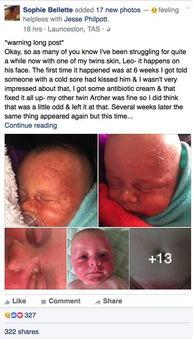 成人亲吻宝宝的危害视频-第2张图片-草莓视频分享平台